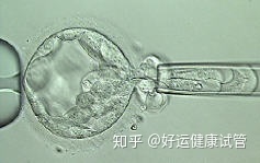 好运健康三代试管知男女的必经之路—胚胎活检术_知乎_(图10) 好运健康三代试管知男女的必经之路—胚胎活检术_知乎_(图10)