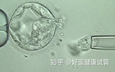 好运健康三代试管知男女的必经之路—胚胎活检术_知乎_(图12) 好运健康三代试管知男女的必经之路—胚胎活检术_知乎_(图12)