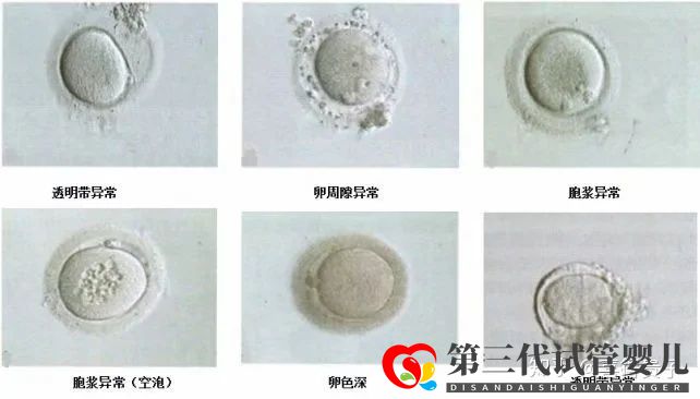 夫妻染色体正常,但胚胎染色体异常,什么原因引起(图10)