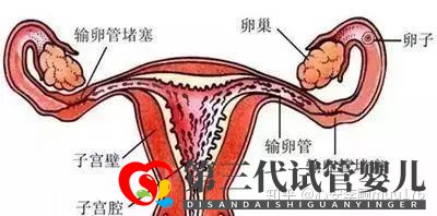 人工授精跟试管婴儿的区别(图5)