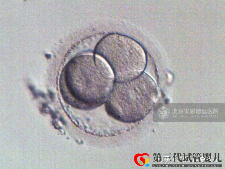 输卵管堵塞是先疏通还是直接试管_生殖妇科医生给..._知乎_(图5) 输卵管堵塞是先疏通还是直接试管_生殖妇科医生给..._知乎_(图5)