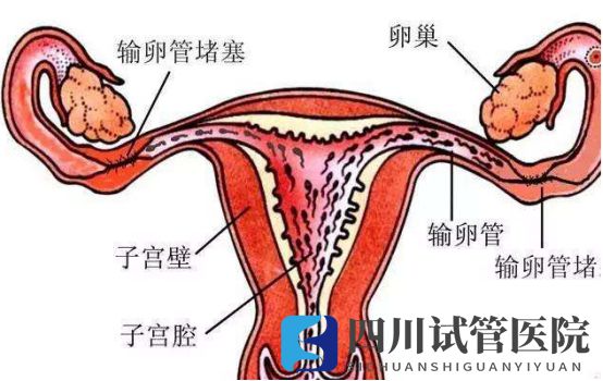 成都两侧输卵管堵塞想要孩子，听说试管婴儿是最好的选择(图1)