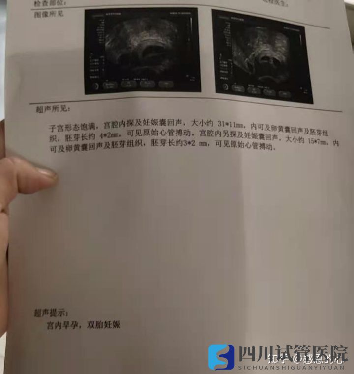 我在成都做三代试管的经历(标图接好孕)(图3)