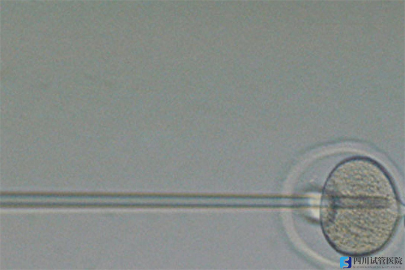 做供卵试管的你们后悔了吗？(图1)