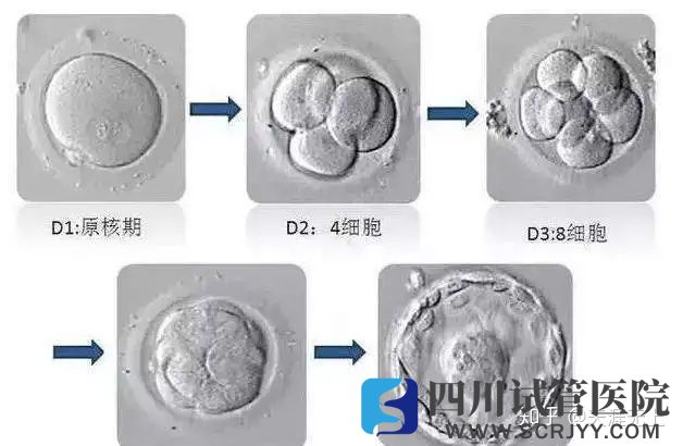 试管婴儿选取移植胚胎的标准是什么(图1)