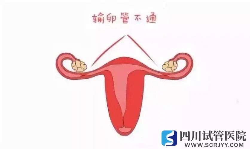 输卵管的这两项功能对怀孕至关重要，怎么知道它好不好？(图1)