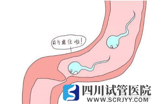 输卵管如果不通,精子和卵子只能遥遥相对(图1)