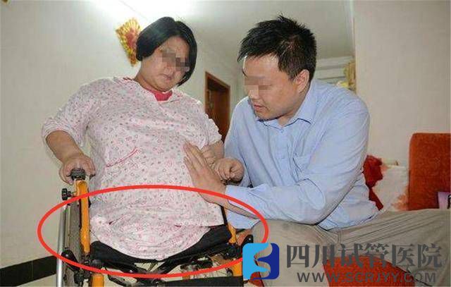 “无腿”妈妈试管生下双胞胎，如今5年过去，一家人现状如何？(图1)