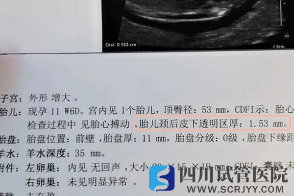胎儿颈后透明带增厚表示存在致病风险