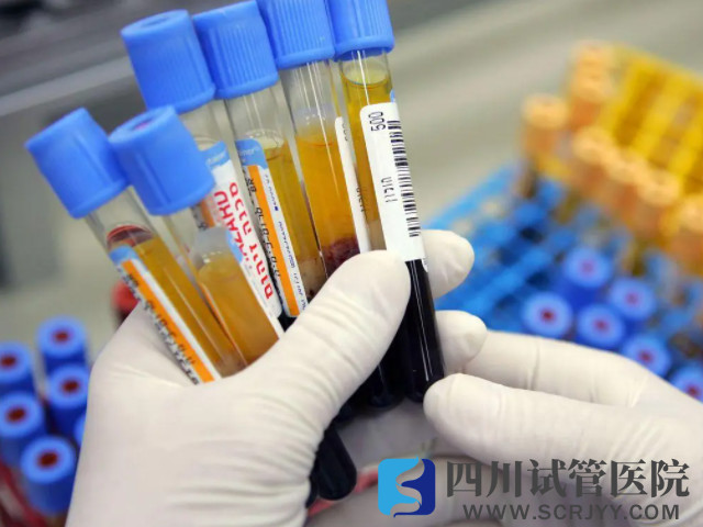 成都夫妻备孕检查清单一览,按顺序做完才能生健康宝宝(图3) 备孕需要要做性激素六项检查